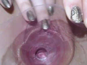 Cherry recomended images Deep inside the vagina