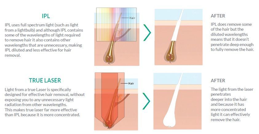 Han S. reccomend Depth of penetration of infrared laser