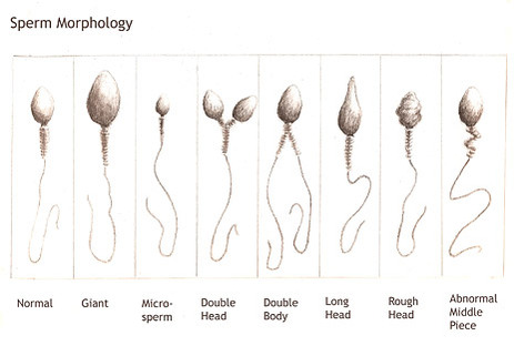 best of Damaged sperm Chromosome