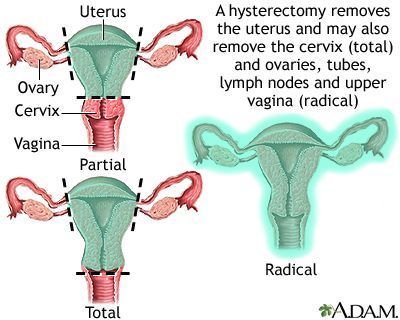 How soon for orgasm after hysterectomy