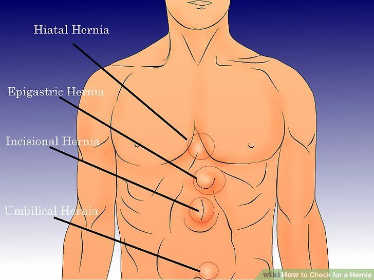 Inguinal hernia repair strange anus feelings