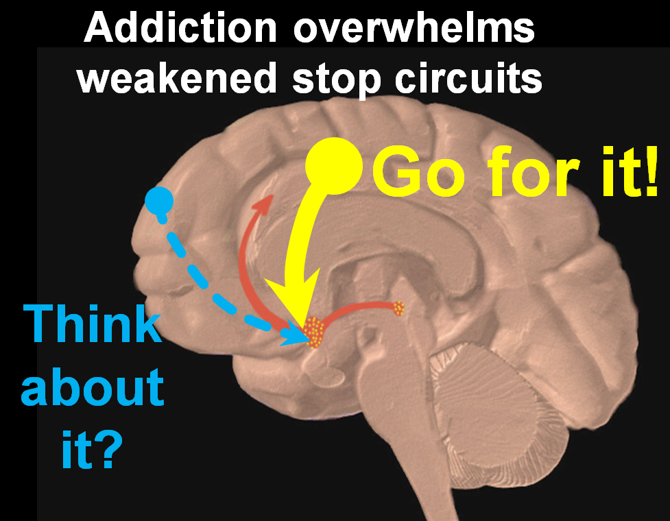Masturbation addiction in the brain injured