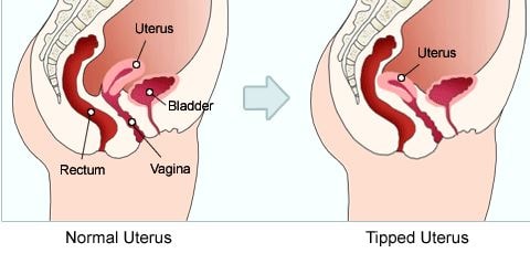 Sentinel recommendet uterus Sex inverted position with
