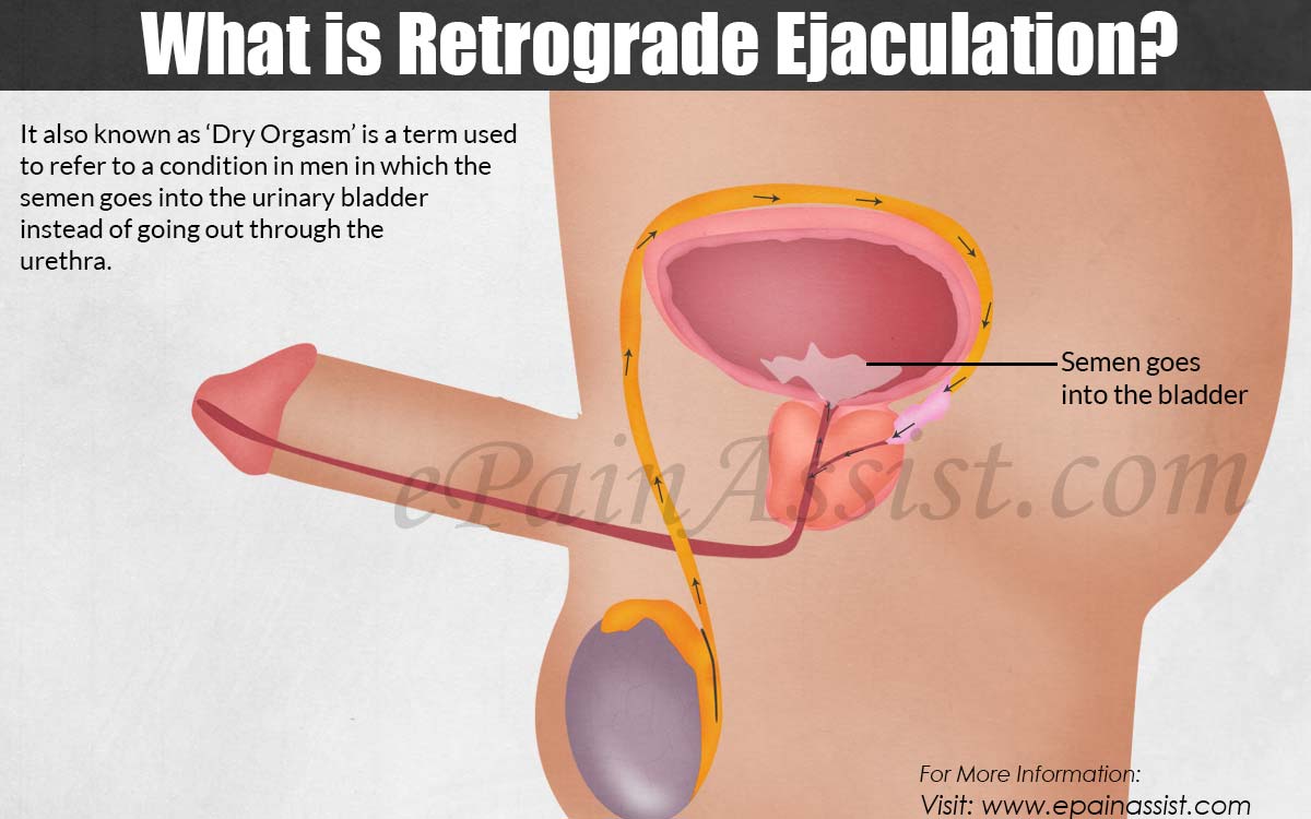 best of Orgasm Retrograde ejaculation