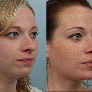best of Reconstructive Schenectady surgery facial