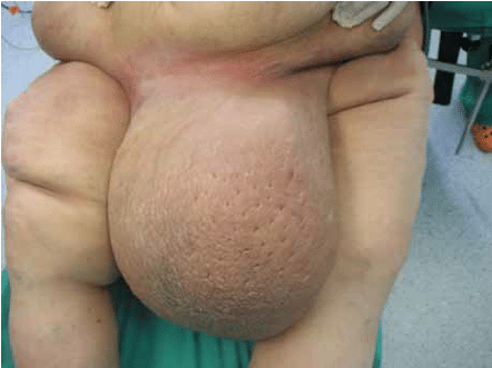 Marine reccomend Giant pic vulva