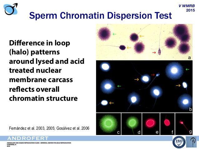 best of Sperm chromatin Testing