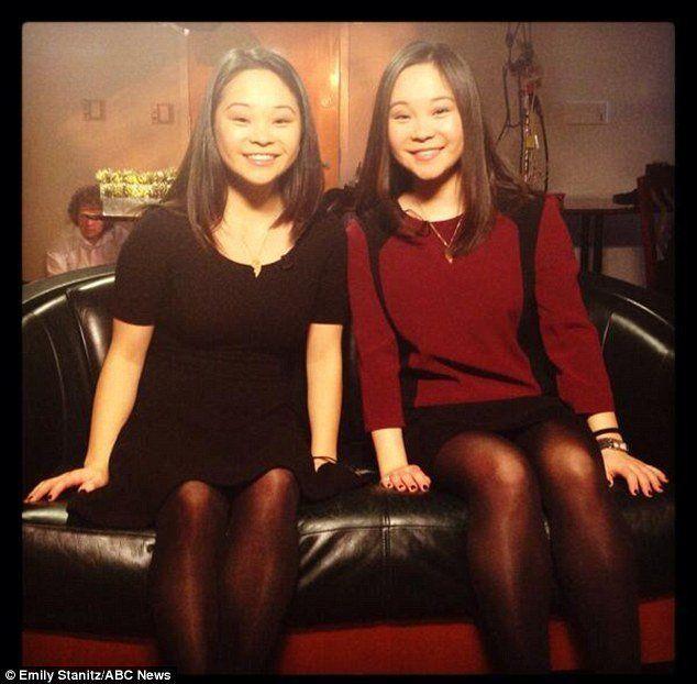 Asian twins separted