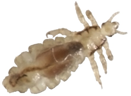 Bullseye reccomend Adult lice pic