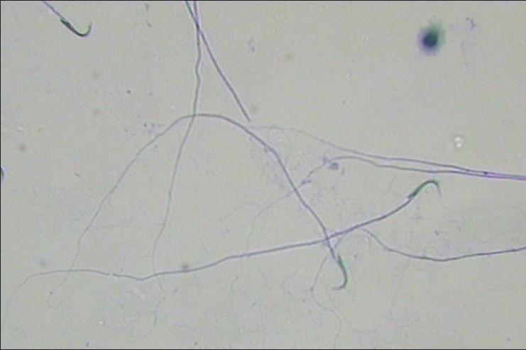 Microscope images of stained sperm