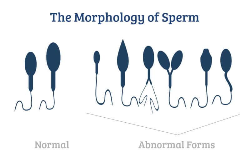 How long is sperm fertile