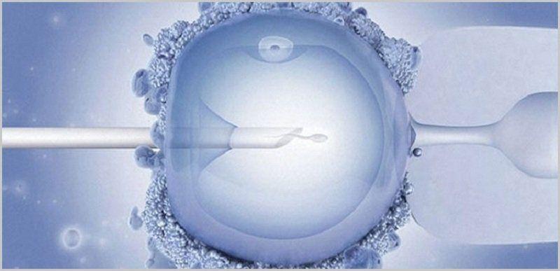 Motor reccomend Icsi intracytoplasmic sperm injection