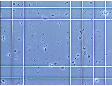 Sperm count and hemocytometer