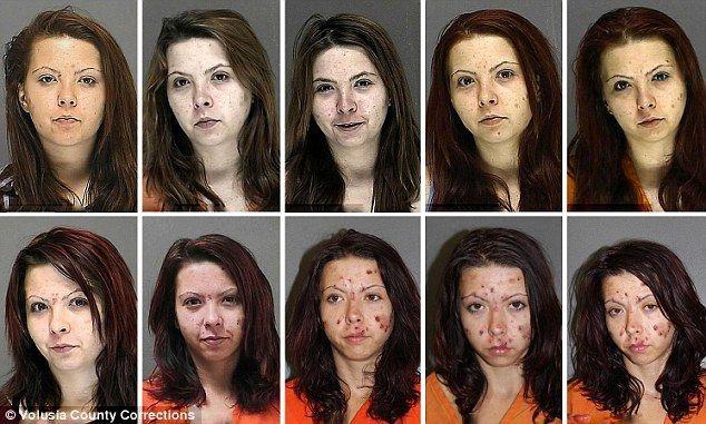 Can meth cause facial cysts