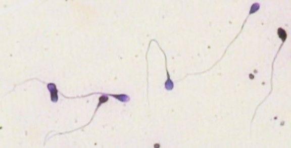 Dingo reccomend Microscope images of stained sperm