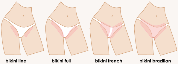 AK47 reccomend Brizillian bikini wax