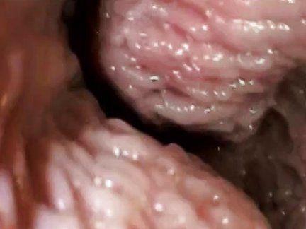 Vagina camera inside The 'sex