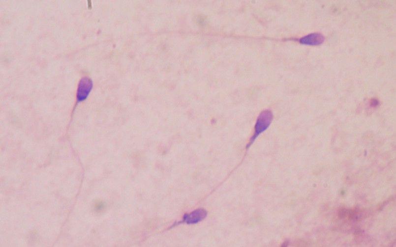 Kawaii reccomend Microscope images of stained sperm