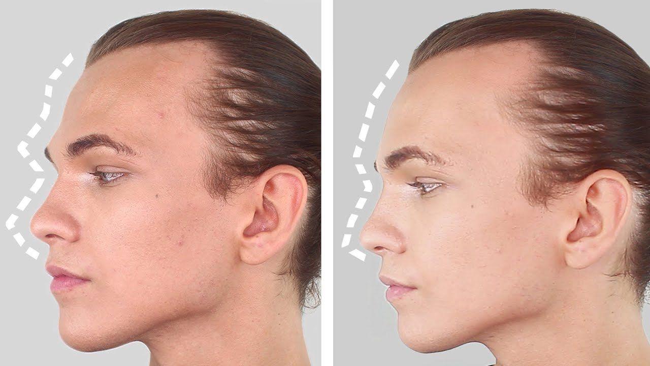 best of Surgery Facial feminisation