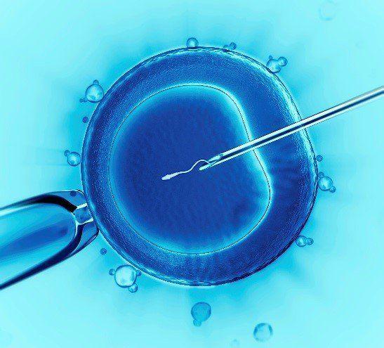 Icsi intracytoplasmic sperm injection
