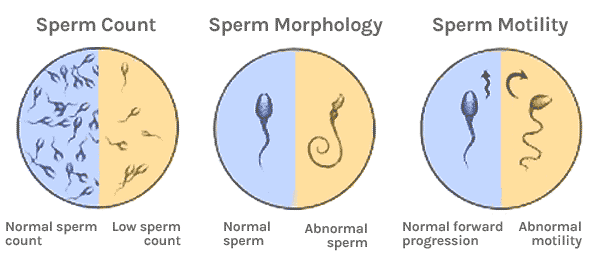 Patton reccomend Poor sperm morphology and pregnancy
