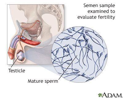Sperm damage fertility sex ejaculation