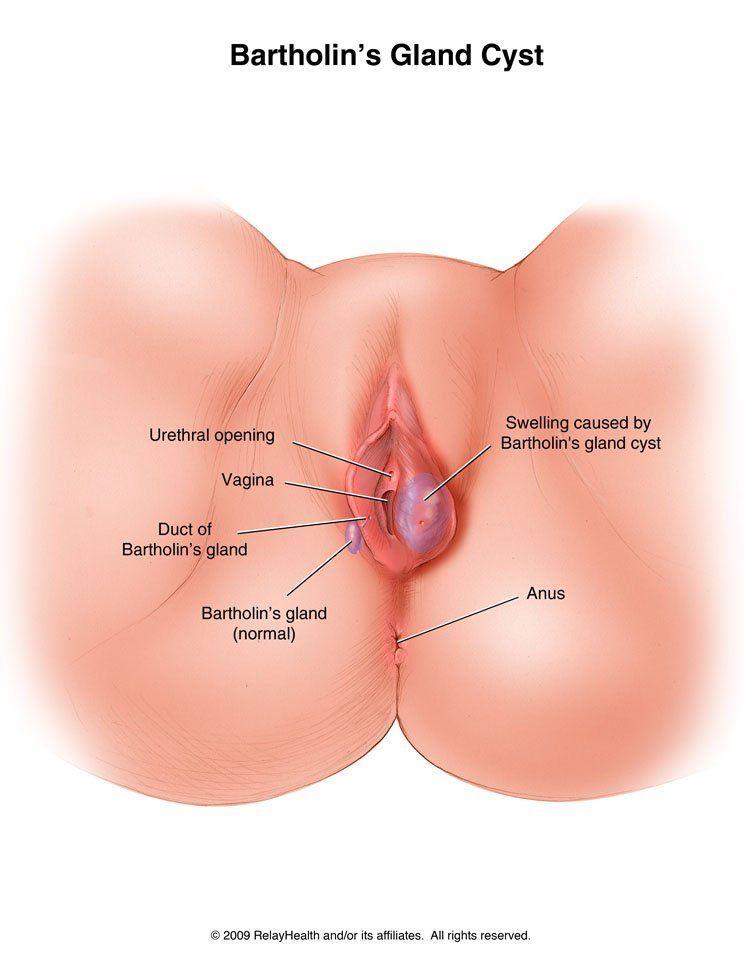 Meatball reccomend Vulva swelling after intercourse